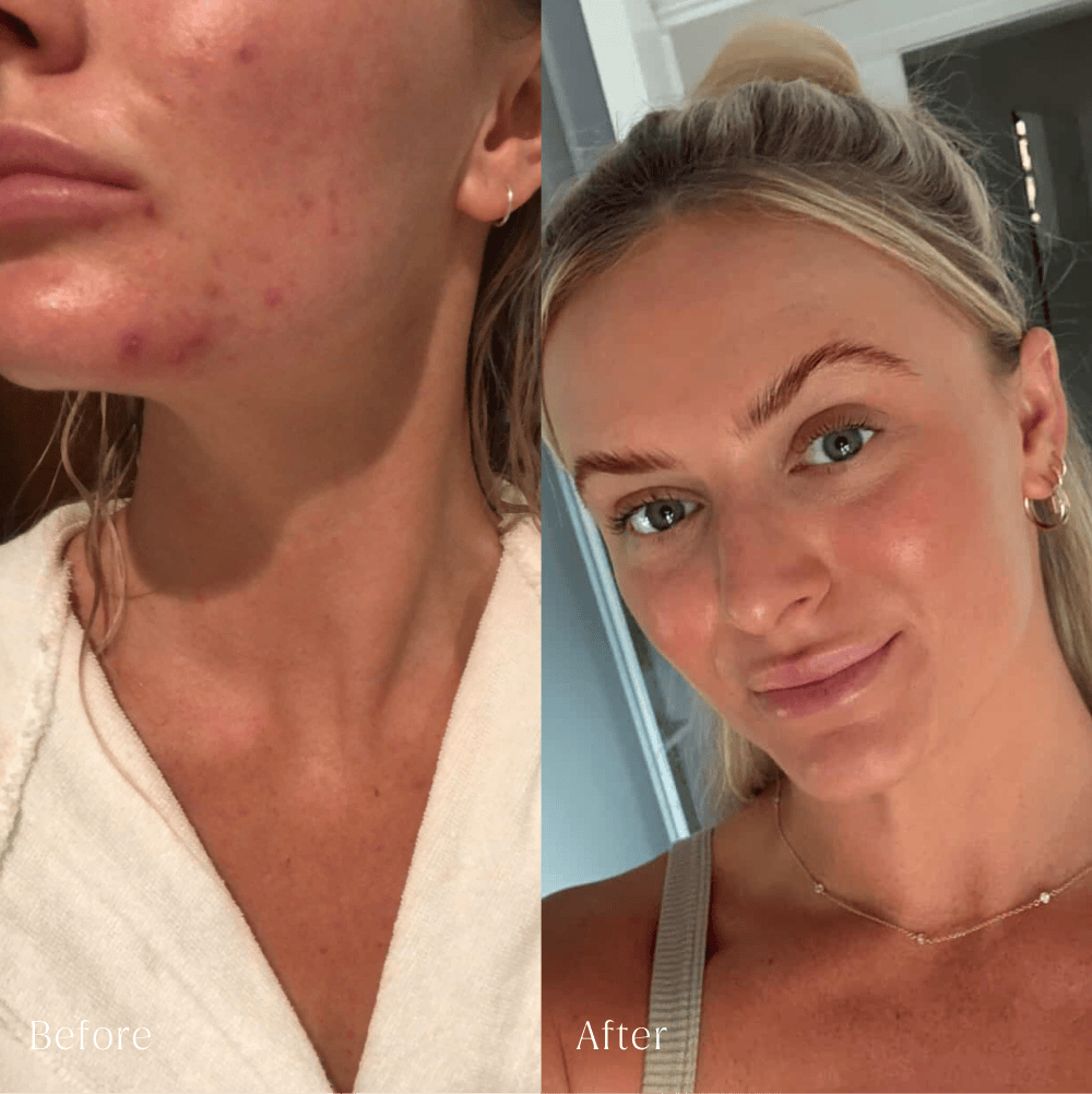 filtered shower head