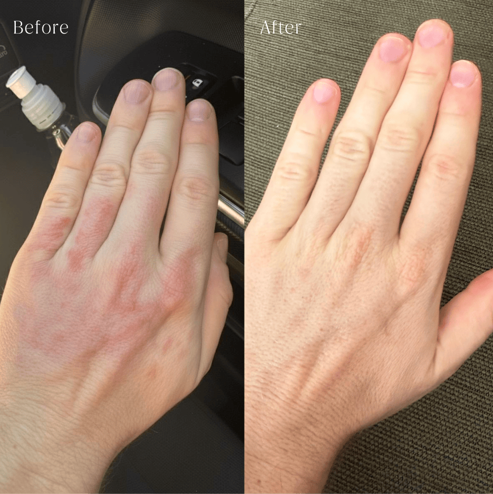 filtered shower head